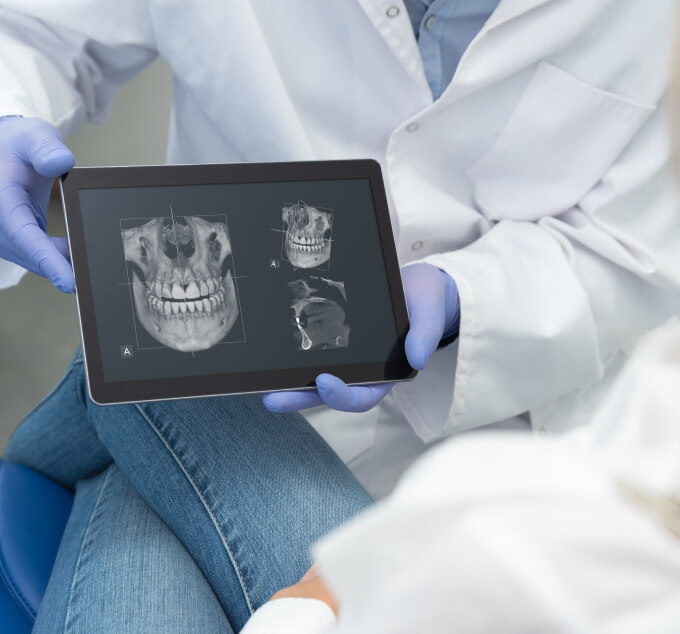 Digital x-rays - dentist in Swansea, IL