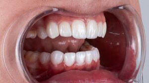 Cosmetic,Dentistry,Enhances,The,Appearance,Of,Teeth,,Gums,,And,Smiles